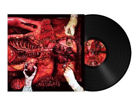 200 Stab Wounds - Manual Manic Procedures - Vinyl Online Hot Sale